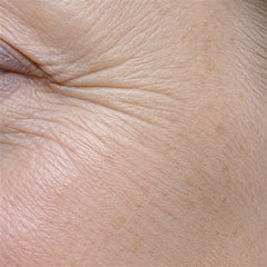 Mature skin with fine lines, macro