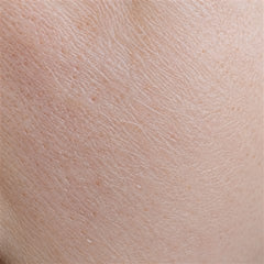 Dehydrated and normal skin, macro