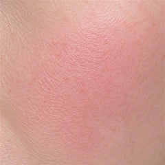 Sensitive skin, macro