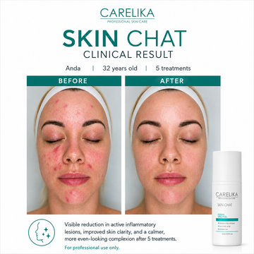 Skin Chat Derma Spiq Peel