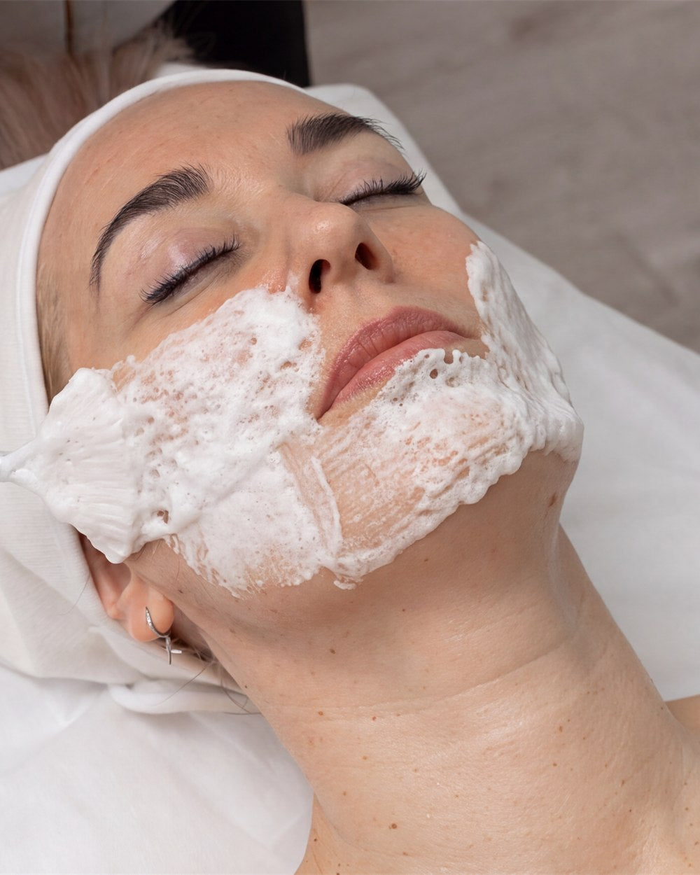 Mode 1: Amber Carboxy Therapy as a stand-alone treatment