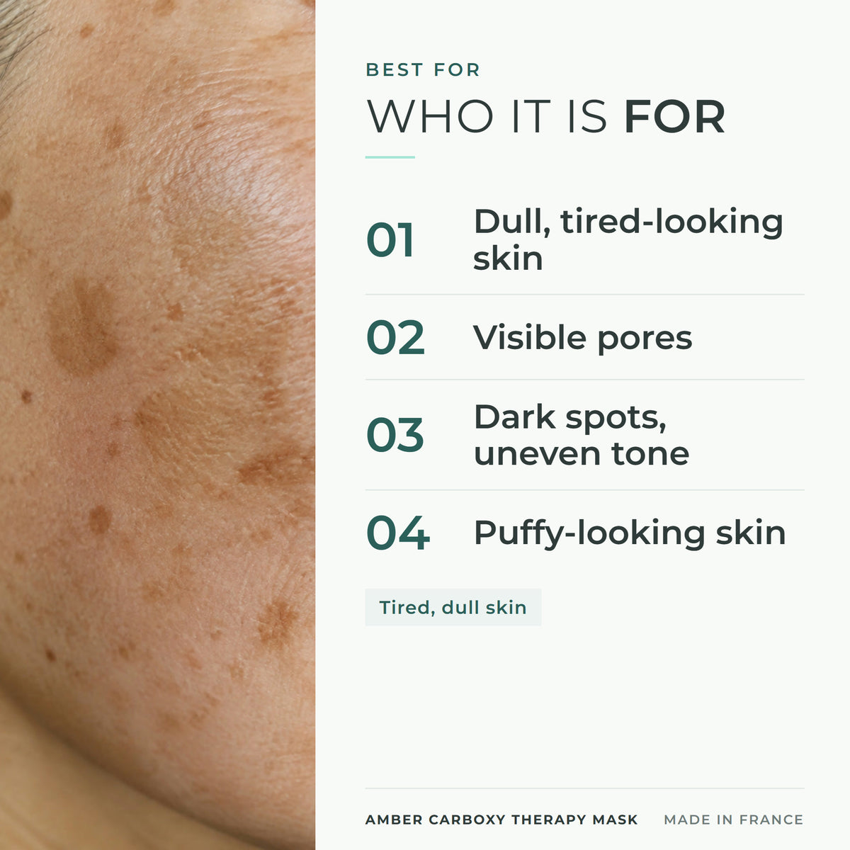 CARELIKA Amber Carboxy Therapy Mask 20 g - who it is for