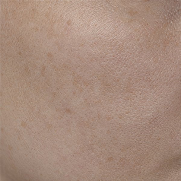 Dull, tired skin