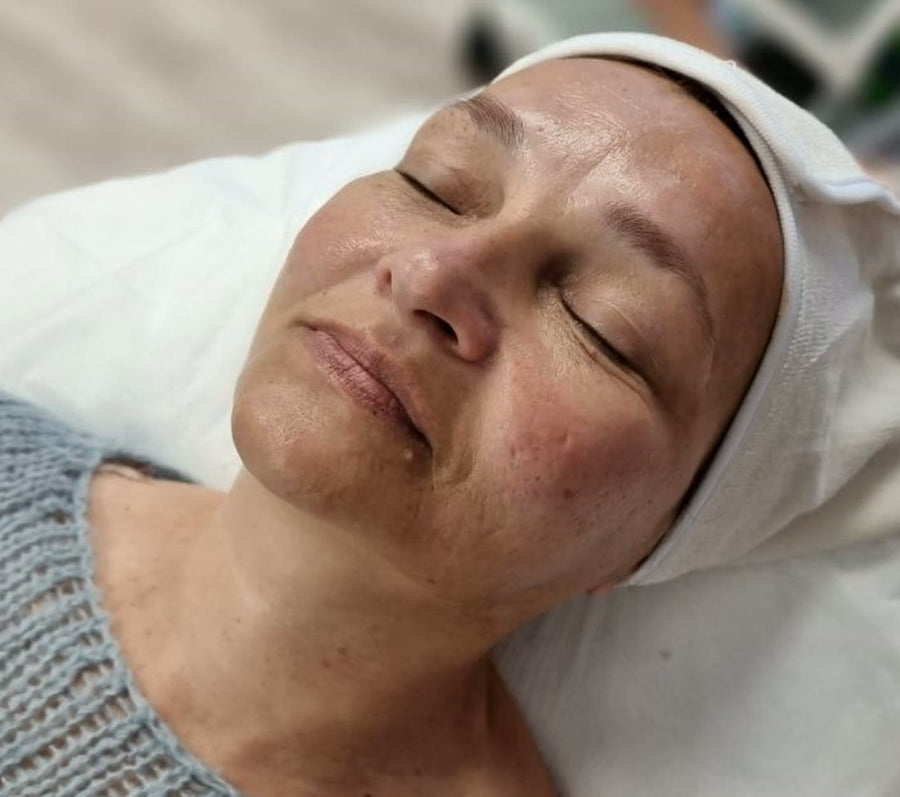 After the CARELIKA Amber protocol