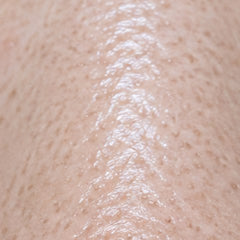 Oily and combination skin with visible pores, macro